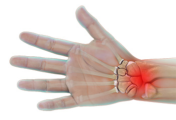 Wrist Pain